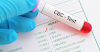 Complete Blood Count (CBC) Test Price in Jammu