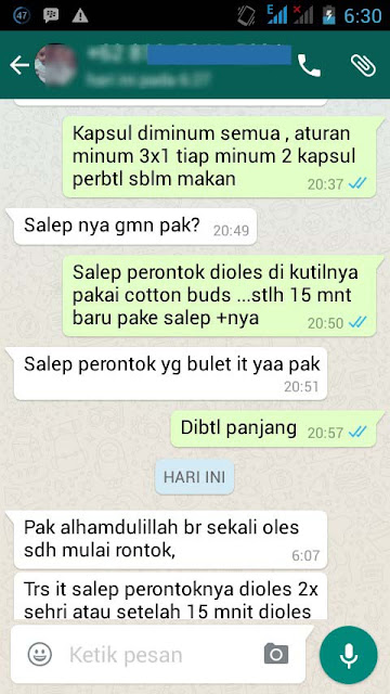 Salep Obat Kutil Kelamin Yang Ada Di Apotik