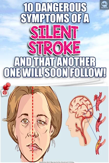 12 Symptoms Which Indicate You Had A Silent Stroke And That Another One Will Follow