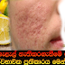 Natural homemade remedy against scars