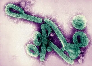 Marburg virus disease confirmed in Guinea