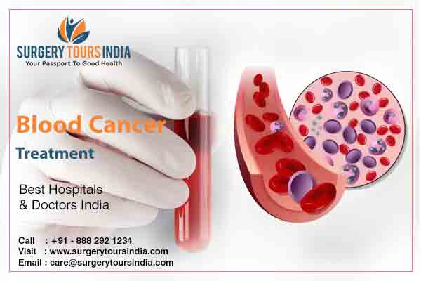 Leukaemia Treatment In India