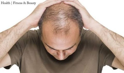 Tips To Prevent Hair Loss