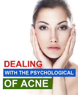Dealing with the Psychological Effects of Acne