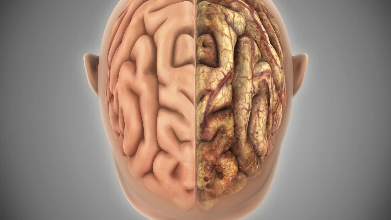 The healthy brain and the unhealthy brain.