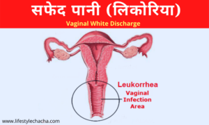 Home remedy for white discharge in Hindi