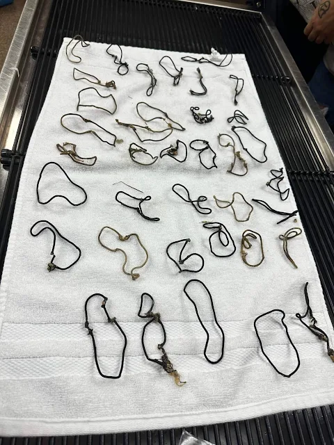 The 38 hair ties removed from the cat's stomach