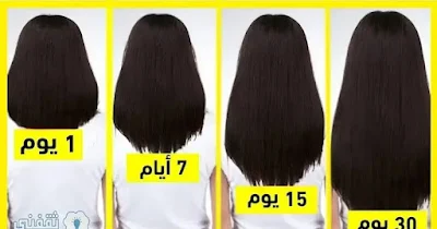 خلطة سحرية لتطويل الشعر 5 سم
