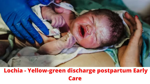 lochia - yellow-green discharge postpartum images