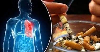 للمدخنين : دراسة حديثة تكشف عن مرض نادر خطير بسبب التدخين.. احترسوا - كتبت منه محمد