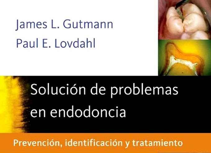 LIBRO DE ODONTOLOGÍA: Solución de problemas en Endodoncia - James Gutmann