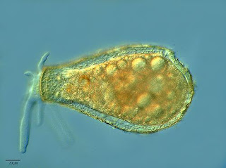Biología Total Protozoo Ameboide Ameba