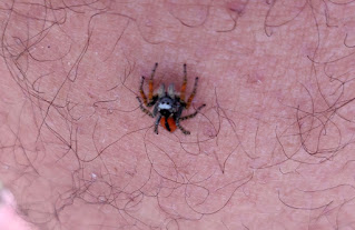 A tiny spider climbing my leg