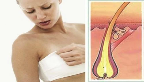 If You Have Small Hairs On Your Chest, Read This Urgently!