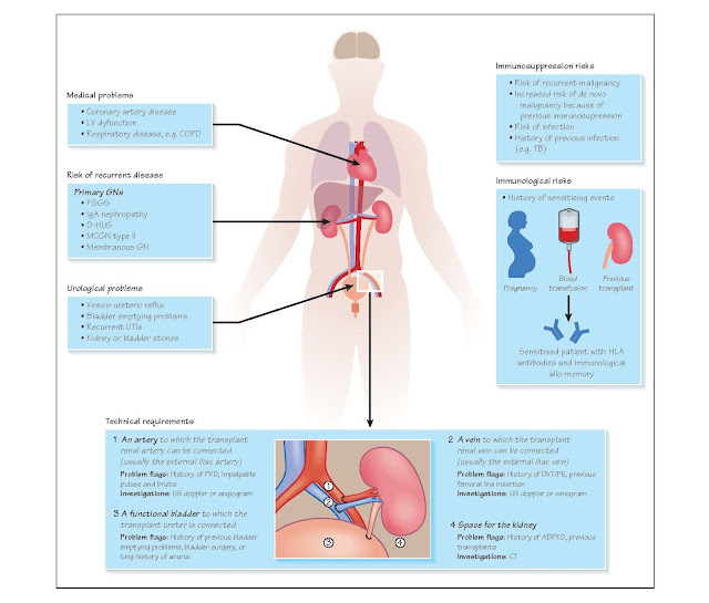 Assessment For Kidney Transplantion