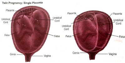 Baby development,stage of zygote, embryonic and stages of fetal development