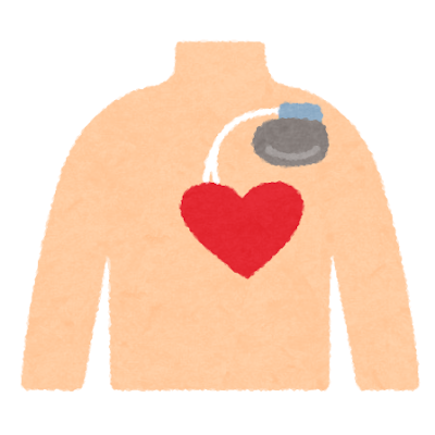 ペースメーカーと心臓のイラスト