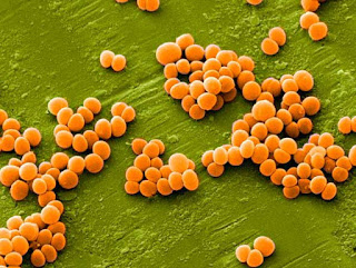 Staphylococcus aureus как представитель условно-патогенных бактерий