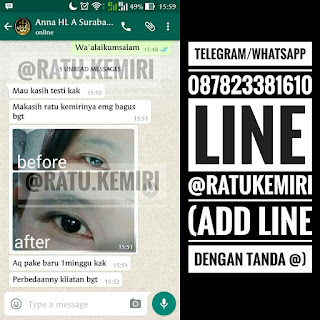 testimoni minyak kemiri penebal alis mata alami ratu kemiri 087823381610