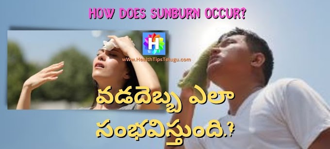  How does sunburn occur? వడదెబ్బ ఎలా సంభవిస్తుంది.? లక్షణాలు?