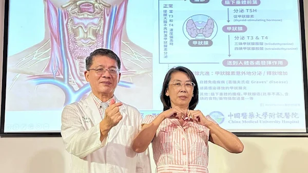 ▲中醫大附醫中醫部黃升騰主任（左）說，50歲林女士（右）因甲亢發生嚴重手抖、血壓高、嚴重飢餓，甚至昏倒，經過中西藥合併服用兩週後，林女士即停止服用西藥，中藥持續服用再四個月後，游離甲狀腺素、甲狀腺荷爾蒙刺激素皆回到正常值，體重由51公斤回復到原來的55公斤。（記者林明佑翻攝）