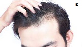 New hope for baldness, first successful hair growth outside the body