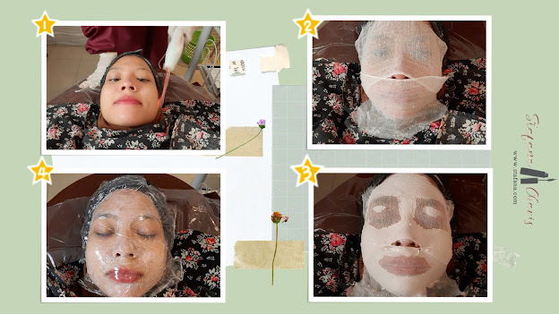 https://www.stafana.com/2020/09/pengalaman-treatment-di-ella-skin-care.html