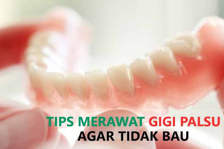 Cara Merawat Gigi Palsu Agar Tidak Berbau, Terutama Gigi Tiruan Lepasan (Tips)