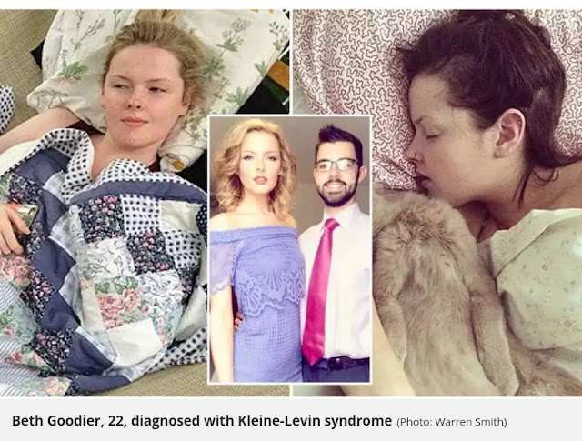  Beth Goodier, 22, diagnosed with Kleine-Levin syndrome (Photo: Warren Smith)