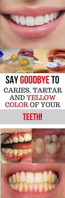 Say Goodbye To Caries, Tartar and Yellow Color of Your Teeth With The Help of This Remedy!