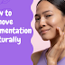 How to Remove Pigmentation Naturally 