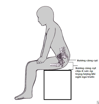Vì sao bị đau xương cụt ?