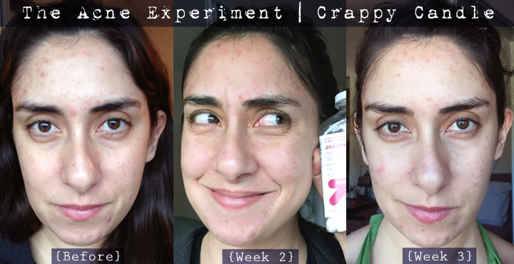 face slimming mask before and after 8 weeks