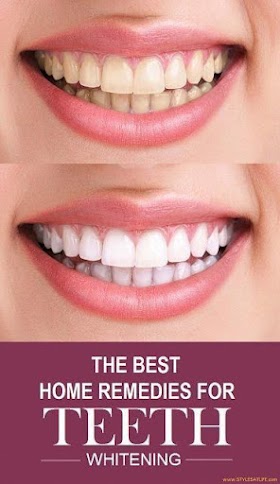 Home Remedies for Teeth Whitening 