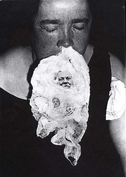 Suposto ectoplasma saindo do nariz de Mary Marshall durante uma sessão, a foto foi tirada por Thomas Glendenning Hamilton, 1932.
