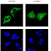 Desarrollan un software bioinformático para predecir el efecto de mutaciones asociadas a cáncer