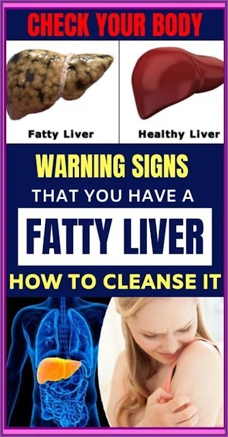 CHECK YOUR BODY: Warning Signs That You Have a Fatty Liver Ways and How to Cleanse It