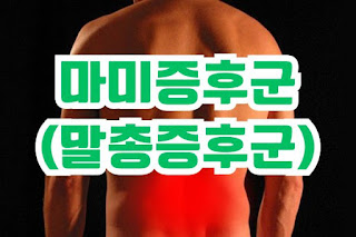 마미증후군(말총증후군)
