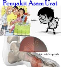 obat asam urat saat menyusui