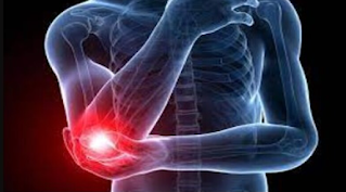 Several Ways to  Prevent and Relieve Tennis Elbow