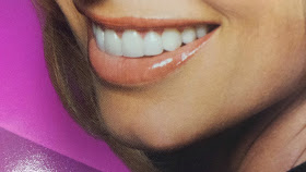 white teeth Bellevue cosmetic dentist
