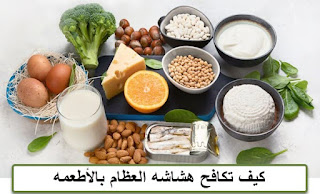 علاج هشاشة العظام