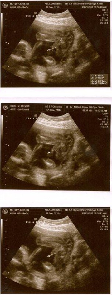 scan0029