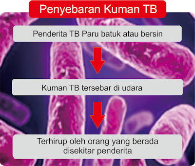 Cara Selamat Mencegah dan Mengatasi Masalah Penyakit Tibi 