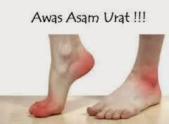 obat asam urat akut