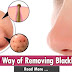 10 Best Way of Removing Blackheads and Whiteheads Without Pain