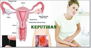 Obat Herbal penyebab vagina keputihan berbau menyengat