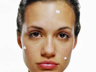 cura para el acne severo