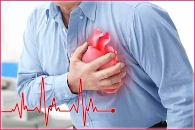 Heart Attack Signs in Men: A Comprehensive Overview