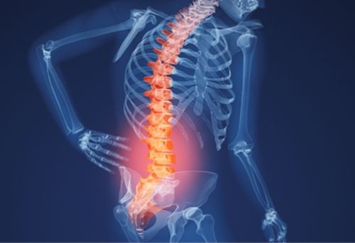 Cách chữa bệnh đau lưng không cần dùng thuốc
